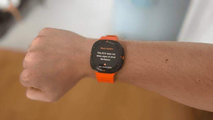 ระบบการแจ้งเตือน – รับข้อความ สายเรียกเข้า และอัปเดตแบบเรียลไทม์บนข้อมือของคุณ